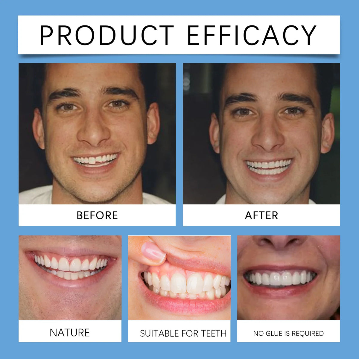 Adjustable Snap-On Cosmetic Dentures for Instant Perfect Smile