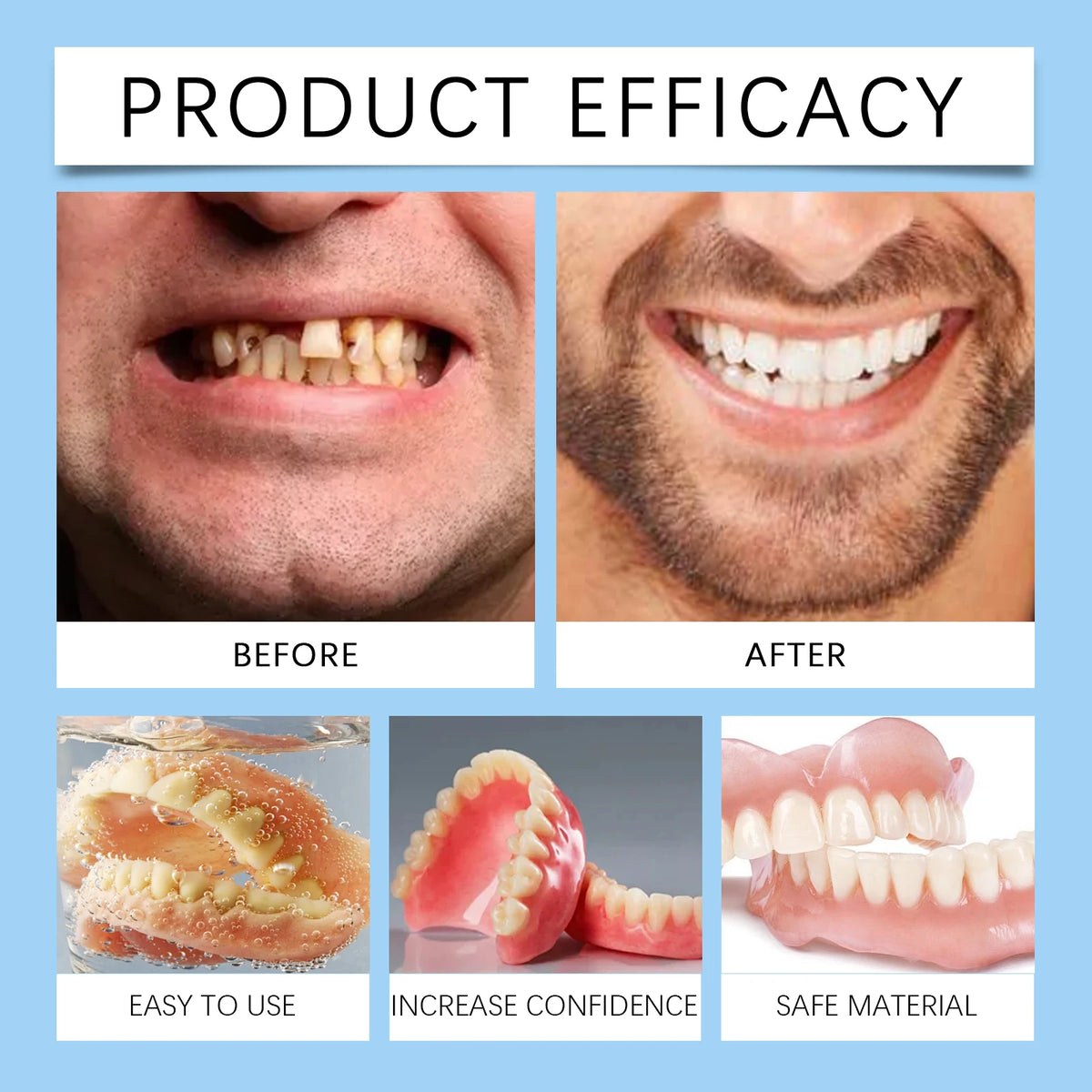 Temporary Snap-On Cosmetic Dentures for Instant Smile Restoration