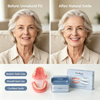 Adjustable Cosmetic Smile Veneer Kit