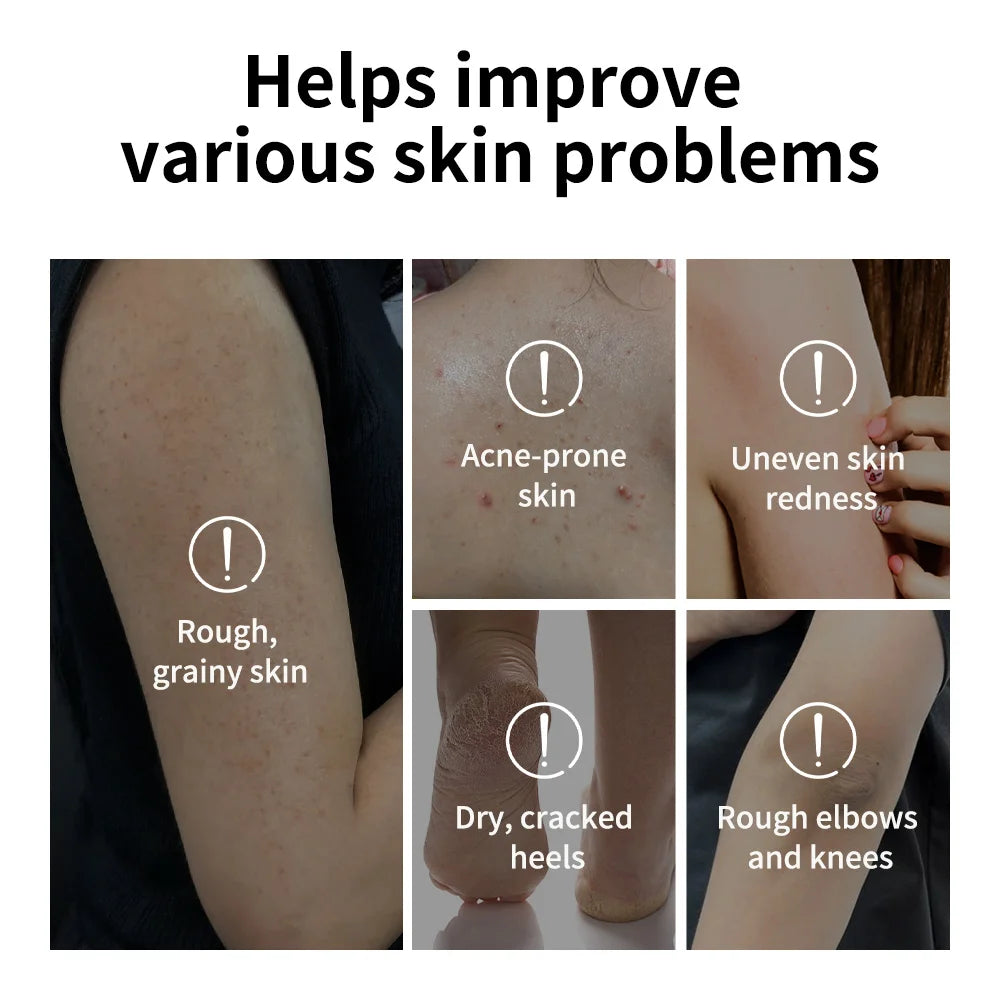 Glycolic Acid Exfoliating Body Stick for Smooth Skin - 5