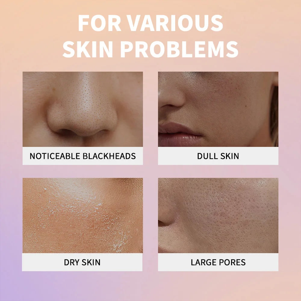 Exfoliating Rice Essence for Deep Pore Cleansing and Brightening