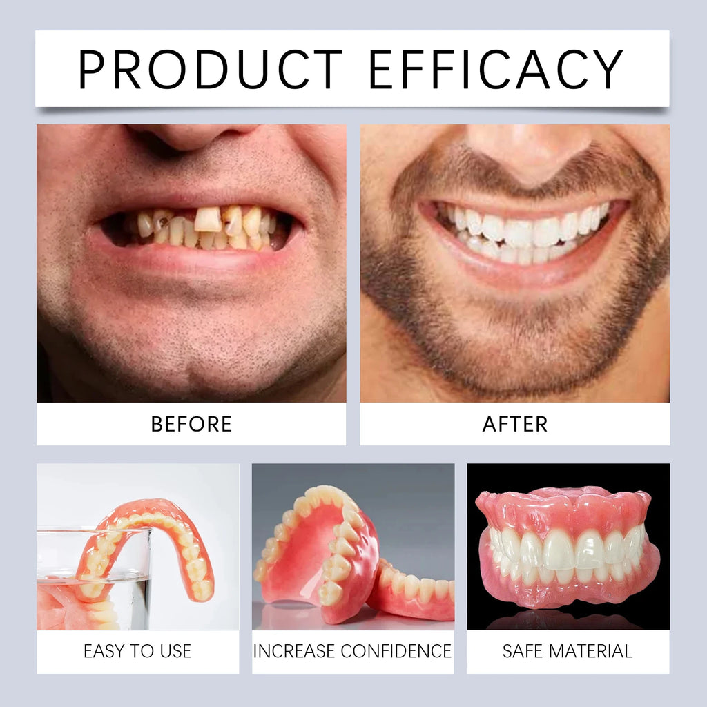 Temporary Silicone Denture Repair and Smile Veneer Kit