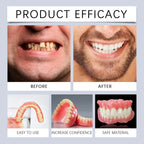 Temporary Silicone Denture Repair and Smile Veneer Kit