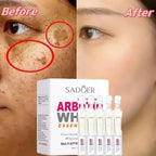 Brightening Niacinamide Facial Serum for Even Skin Tone