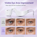 LED Red Light Therapy Eye Massager for Puffiness and Dark Circles