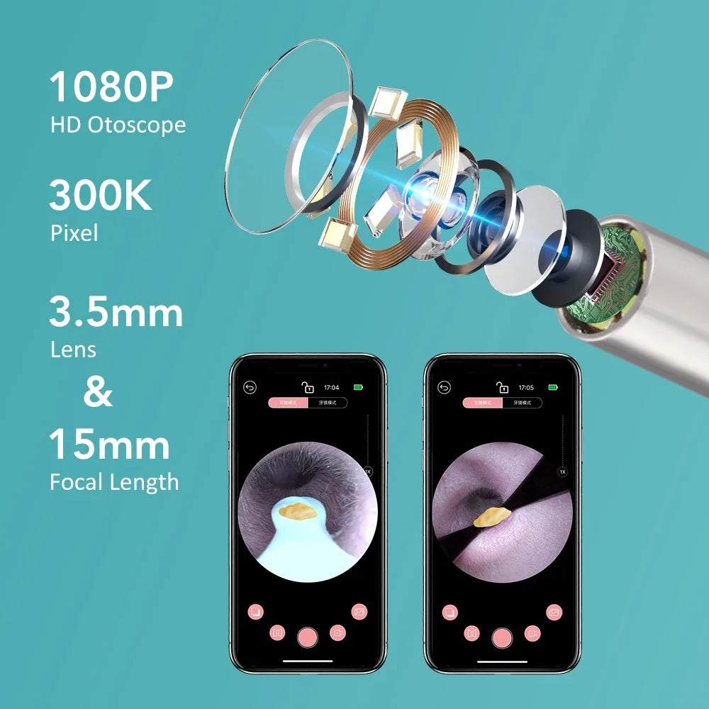 Smart Visual Ear Wax Removal Tool with HD Camera