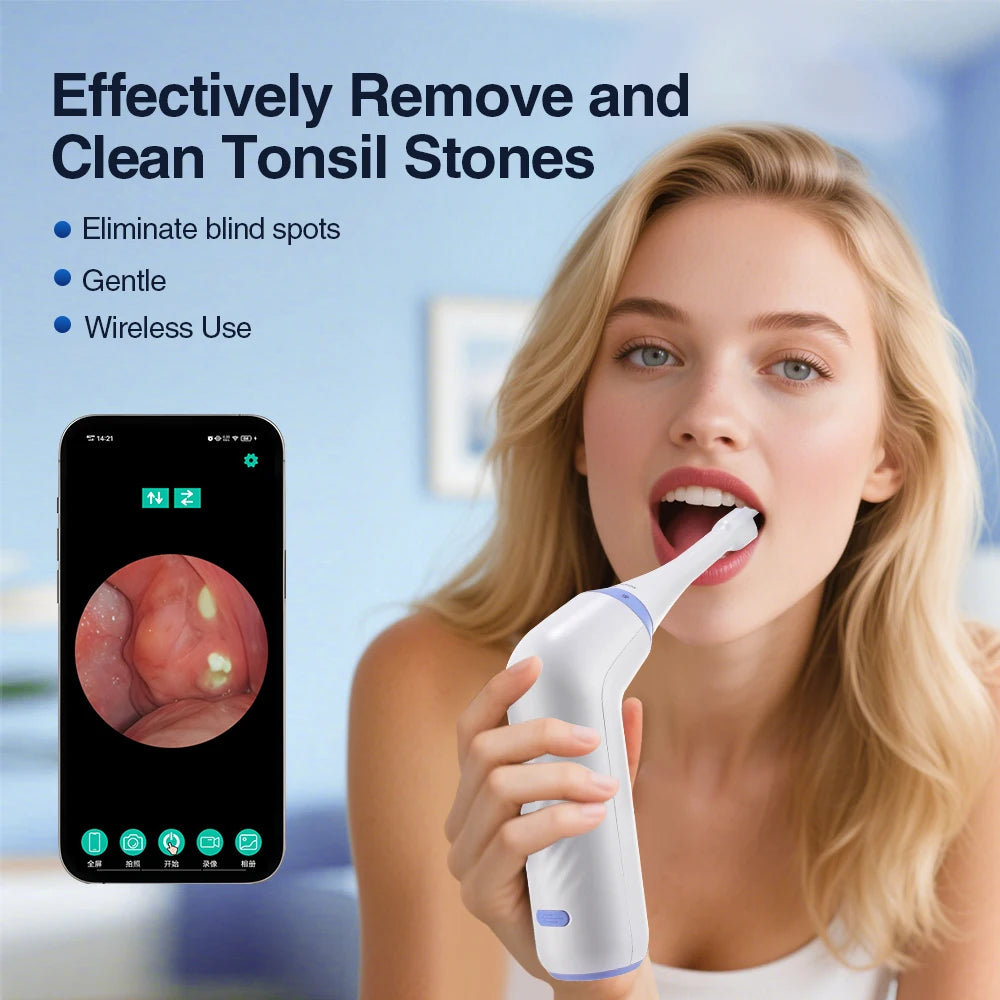 HD Visual Tonsil Stone Removal Vacuum Tool