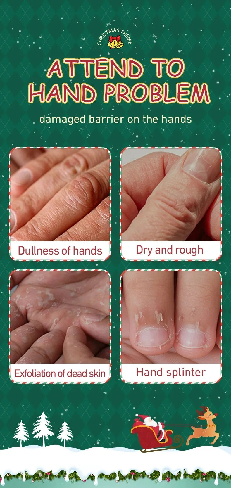 Festive Christmas Hand Cream Set for Deep Hydration - 9