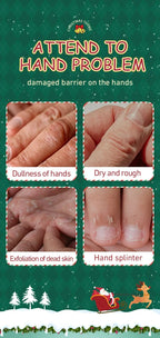 Festive Christmas Hand Cream Set for Deep Hydration