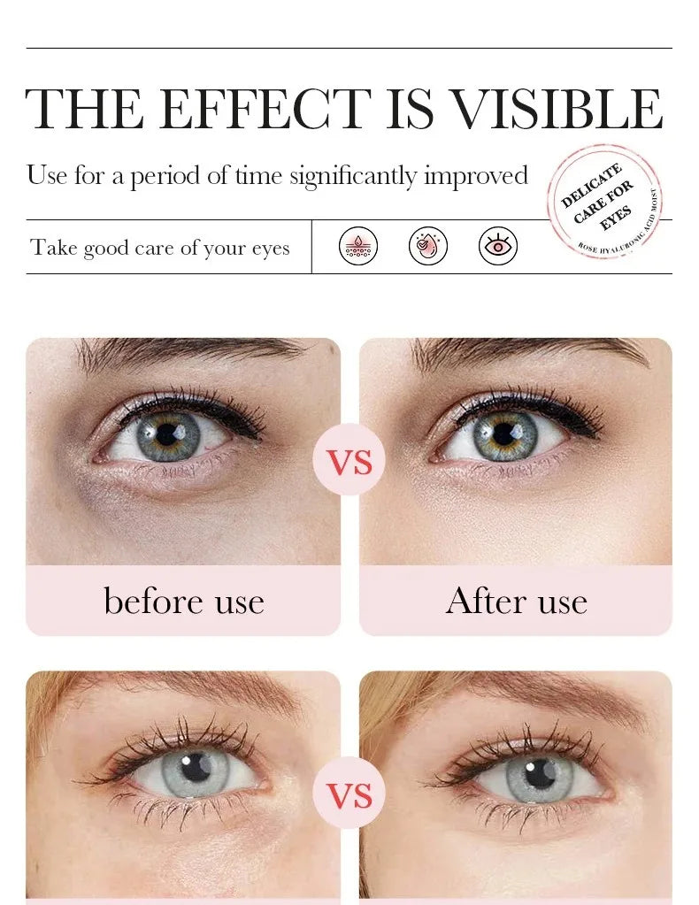 Rose Hyaluronic Acid Moisturizing Eye Mask