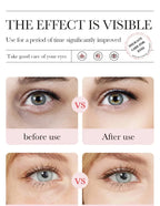 Rose Hyaluronic Acid Moisturizing Eye Mask