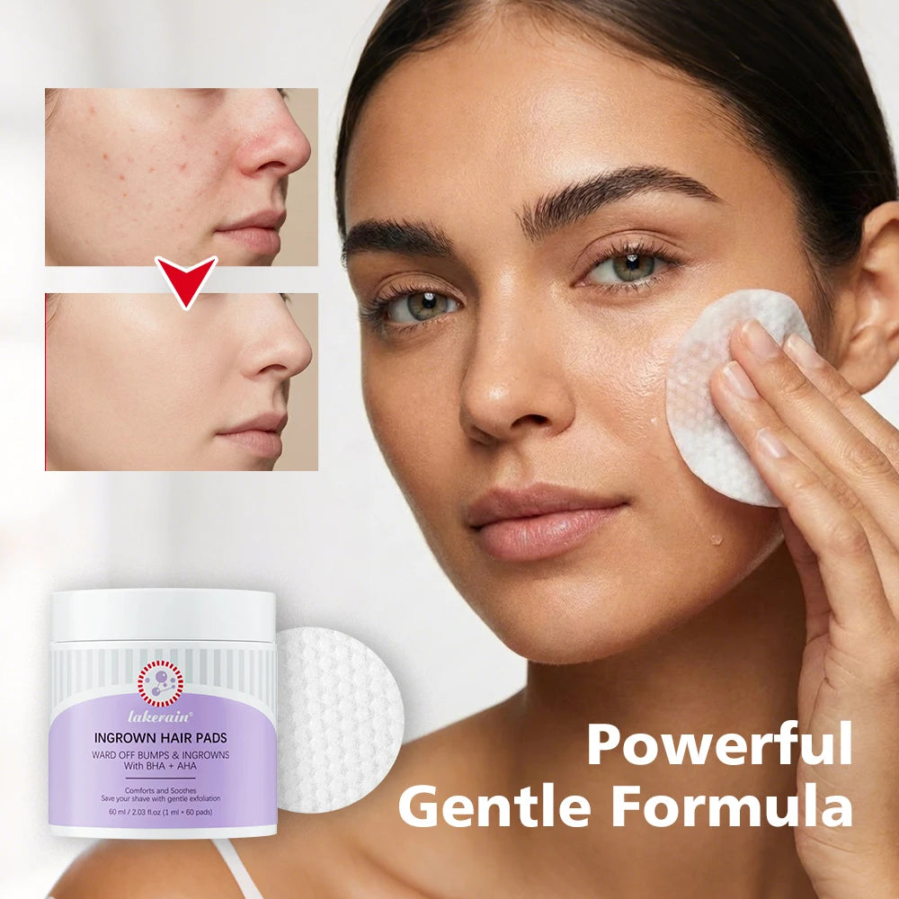 Exfoliating Ingrown Hair and Razor Bump Treatment Pads - 10