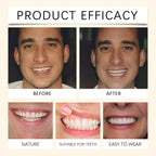 Temporary Silicone Denture Set for Instant Smile Restoration