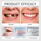 Temporary Cosmetic Dentures for Instant Smile Confidence