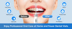 Electric Water Flosser for Teeth and Gum Health