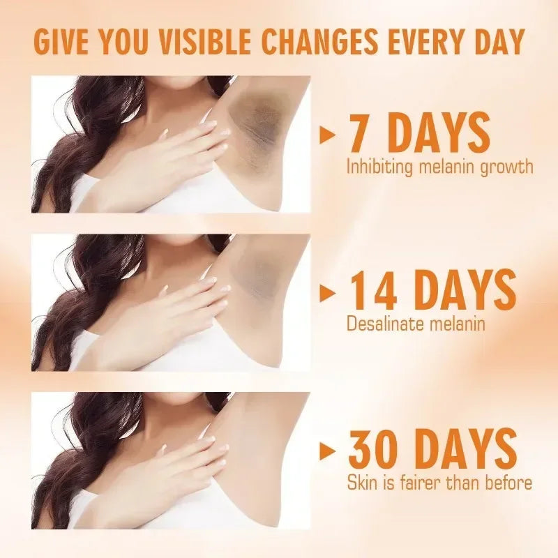 Vitamin C Brightening Cream for Dark Spots and Underarms