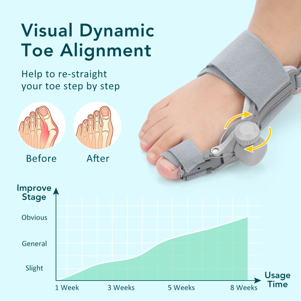 Adjustable Bunion Corrector for Pain Relief and Toe Alignment - 16