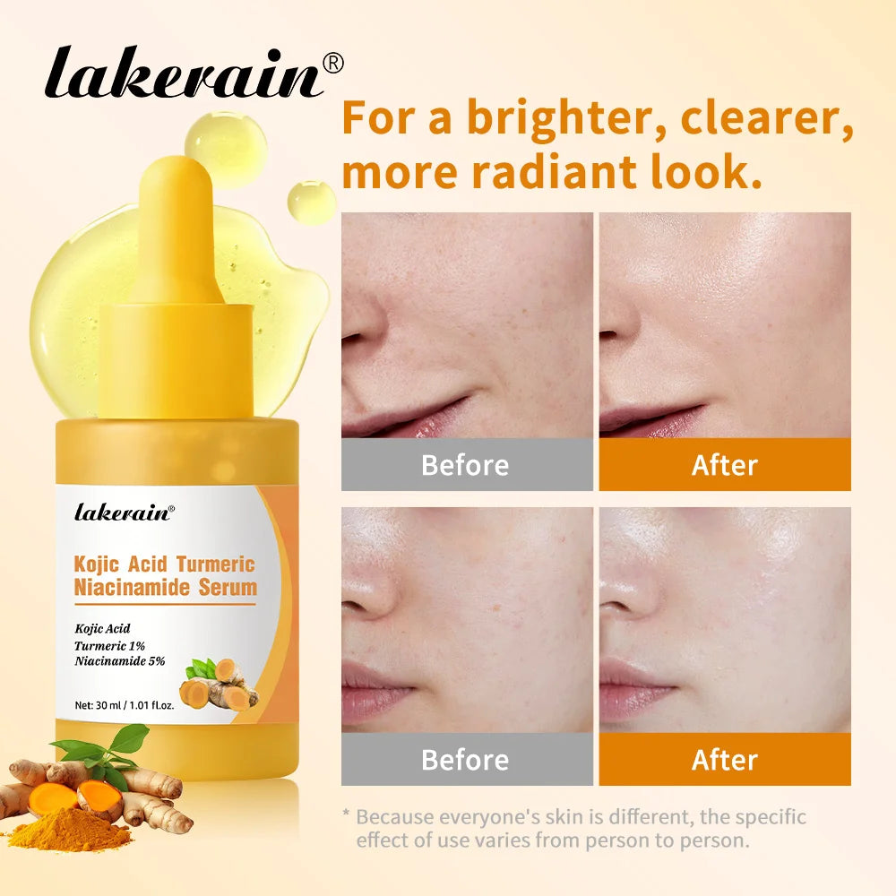 Brightening Kojic Acid and Turmeric Face Serum - 3