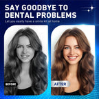 Comfort Fit Snap-On Smile Veneers for Instant Teeth Whitening