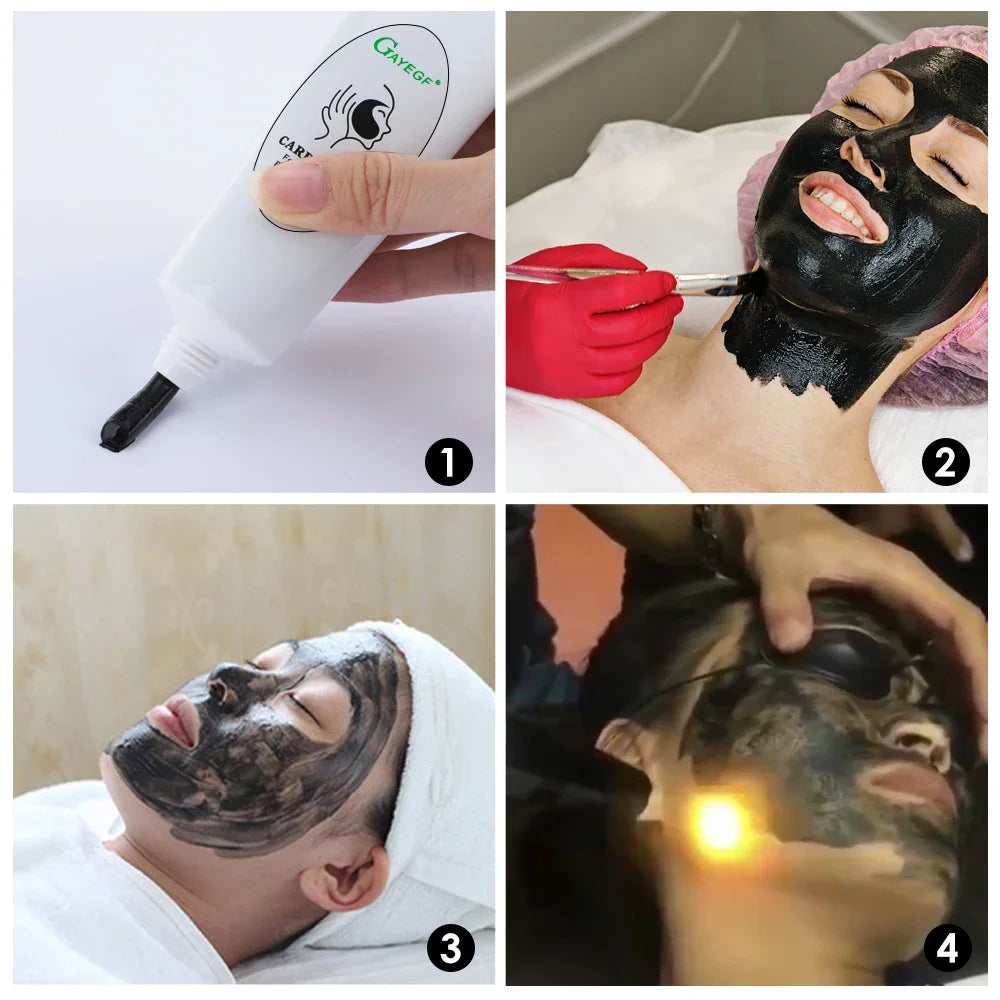 Carbon Laser Facial Gel for Pore Cleansing and Skin Rejuvenation