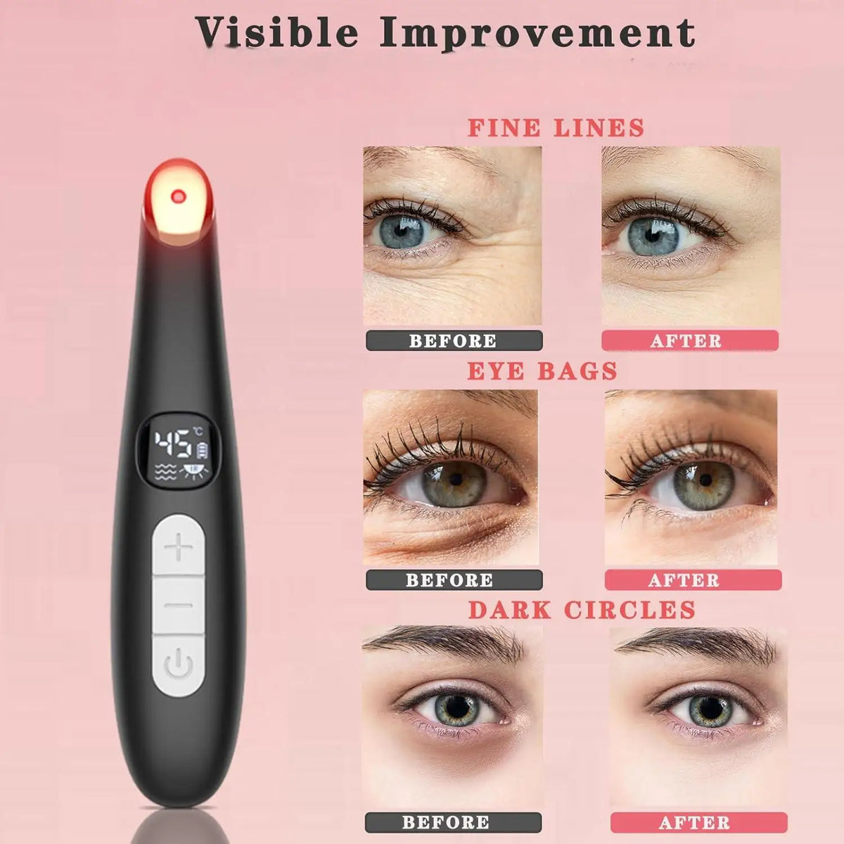 3-in-1 LED Vibrating Eye and Face Rejuvenation Wand