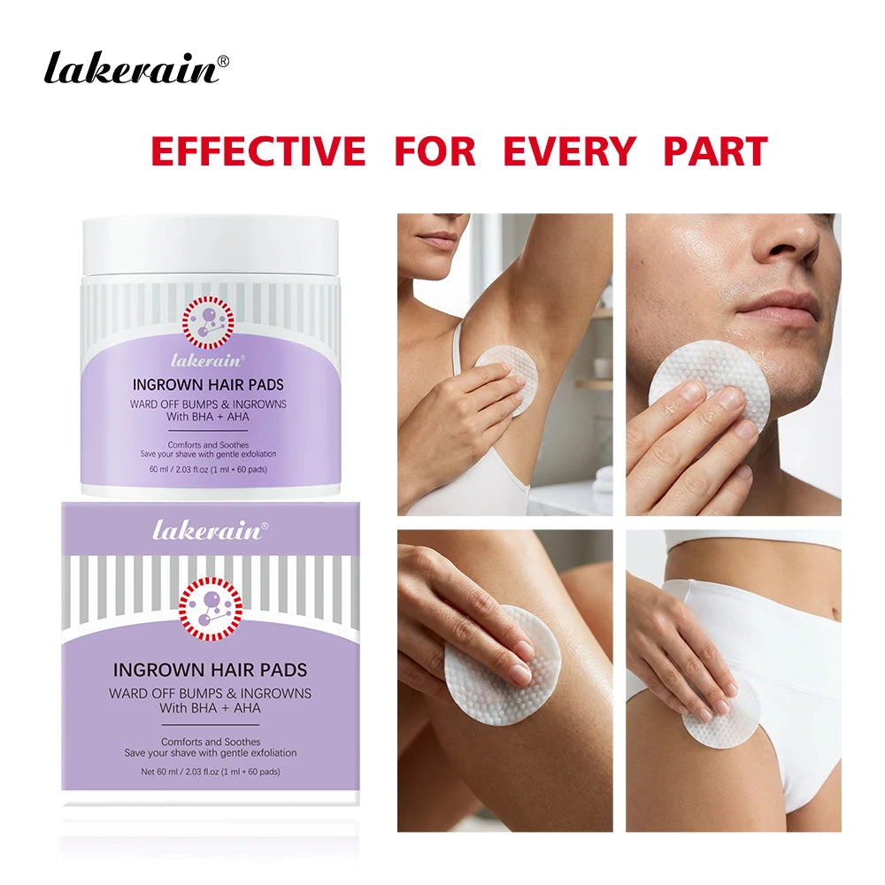 Exfoliating Ingrown Hair and Razor Bump Treatment Pads - 1