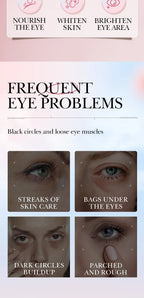 Retinol Anti-Aging Roll-On Eye Cream for Dark Circles