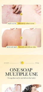 Sulfur Anti-Acne and Mite Removing Facial Soap