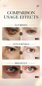 Retinol Anti-Wrinkle Firming Eye Serum for Dark Circles and Puffiness