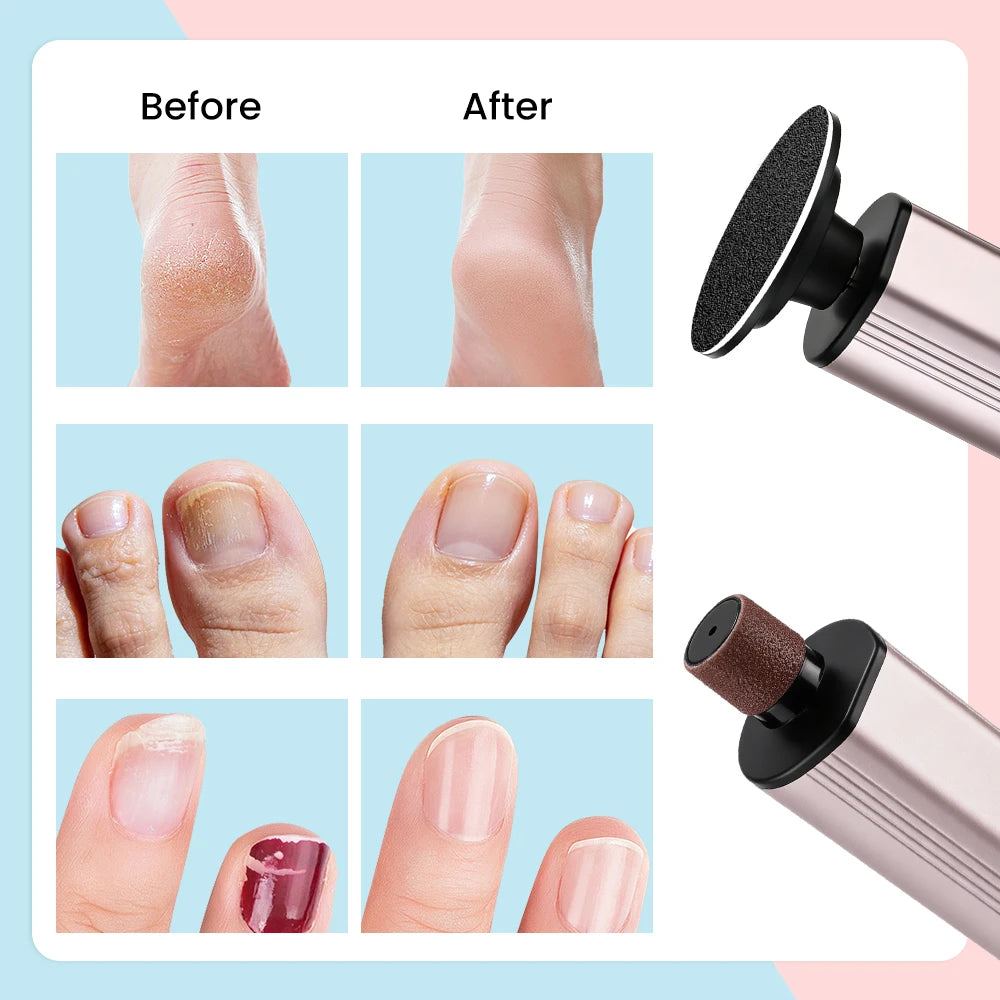 Electric Foot Callus Remover with 9 Speed Settings - 6
