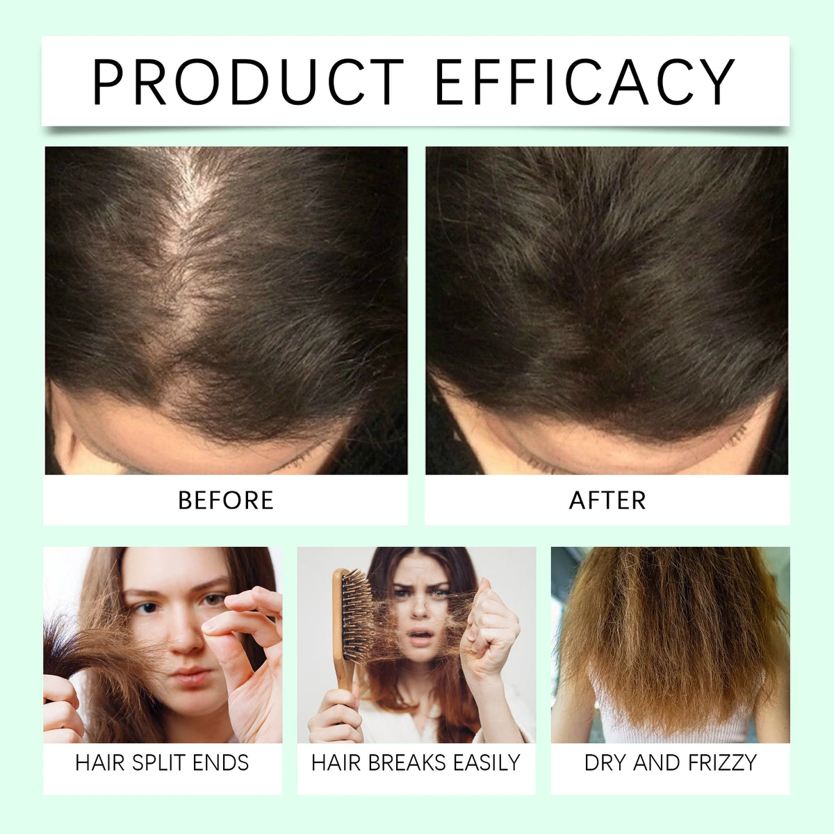 Rosemary Essential Oil for Hair Growth and Scalp Nourishment
