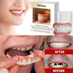 Comfortable Custom-Fit Realistic Denture Set