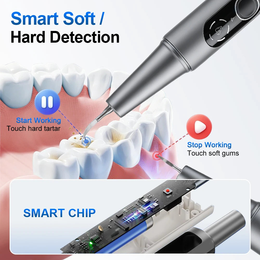 Visual Ultrasonic Teeth Cleaning & Plaque Removal Tool - 11