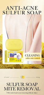 Sulfur Anti-Acne and Mite Removing Facial Soap