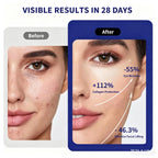 3-in-1 LED Facial Tightening and Rejuvenation Massager