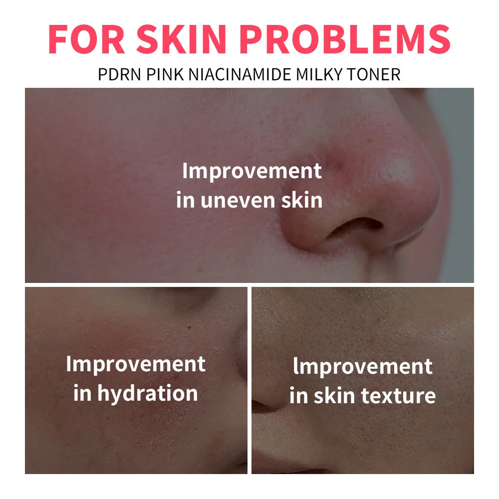 PDRN Niacinamide Milky Facial Toner for Glowing Hydrated Skin