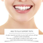 Adjustable Snap-On Cosmetic Dentures for Smile Restoration
