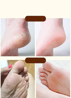 Moisturizing Horse Oil Repair Cream for Dry Cracked Skin