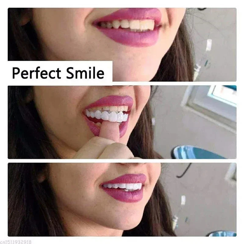 Snap-On Instant Smile Veneers for Temporary Teeth Whitening - 2