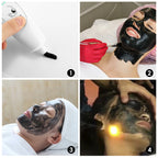 Carbon Laser Facial Gel for Pore Cleansing and Skin Rejuvenation