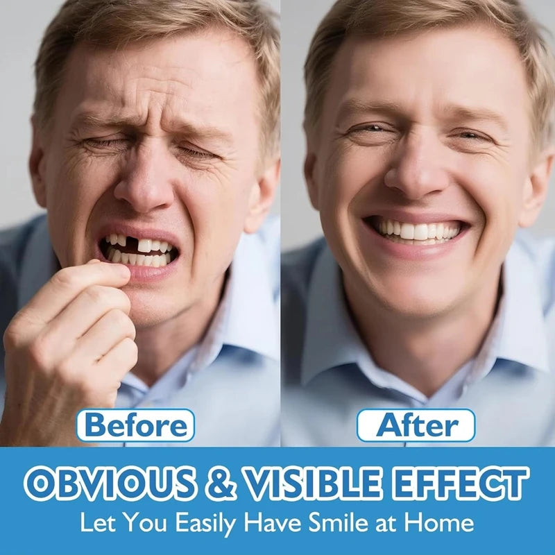 Comfort Fit Instant Smile Dentures for Upper and Lower Teeth