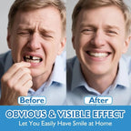 Comfort Fit Instant Smile Dentures for Upper and Lower Teeth