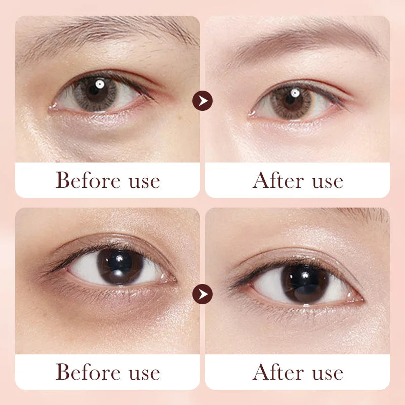 Retinol Anti-Wrinkle Eye Cream Stick for Dark Circles