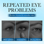 Hydrating Collagen Eye Patches for Dark Circles and Puffiness