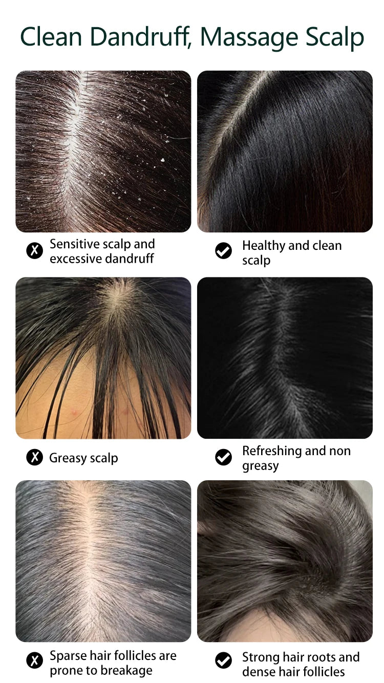 Electric Scalp and Head Massager for Stress Relief