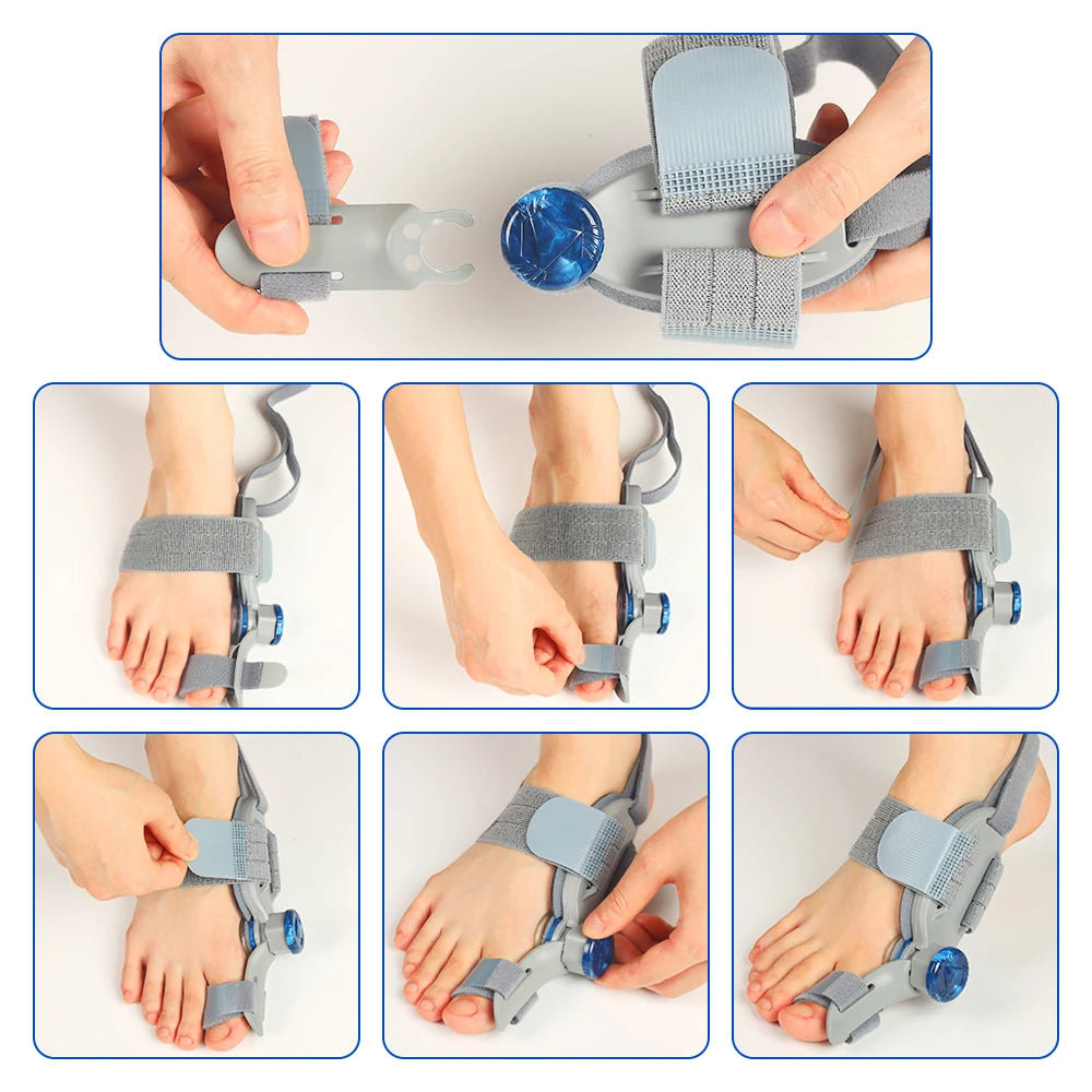 Adjustable Bunion Corrector for Pain Relief and Toe Alignment