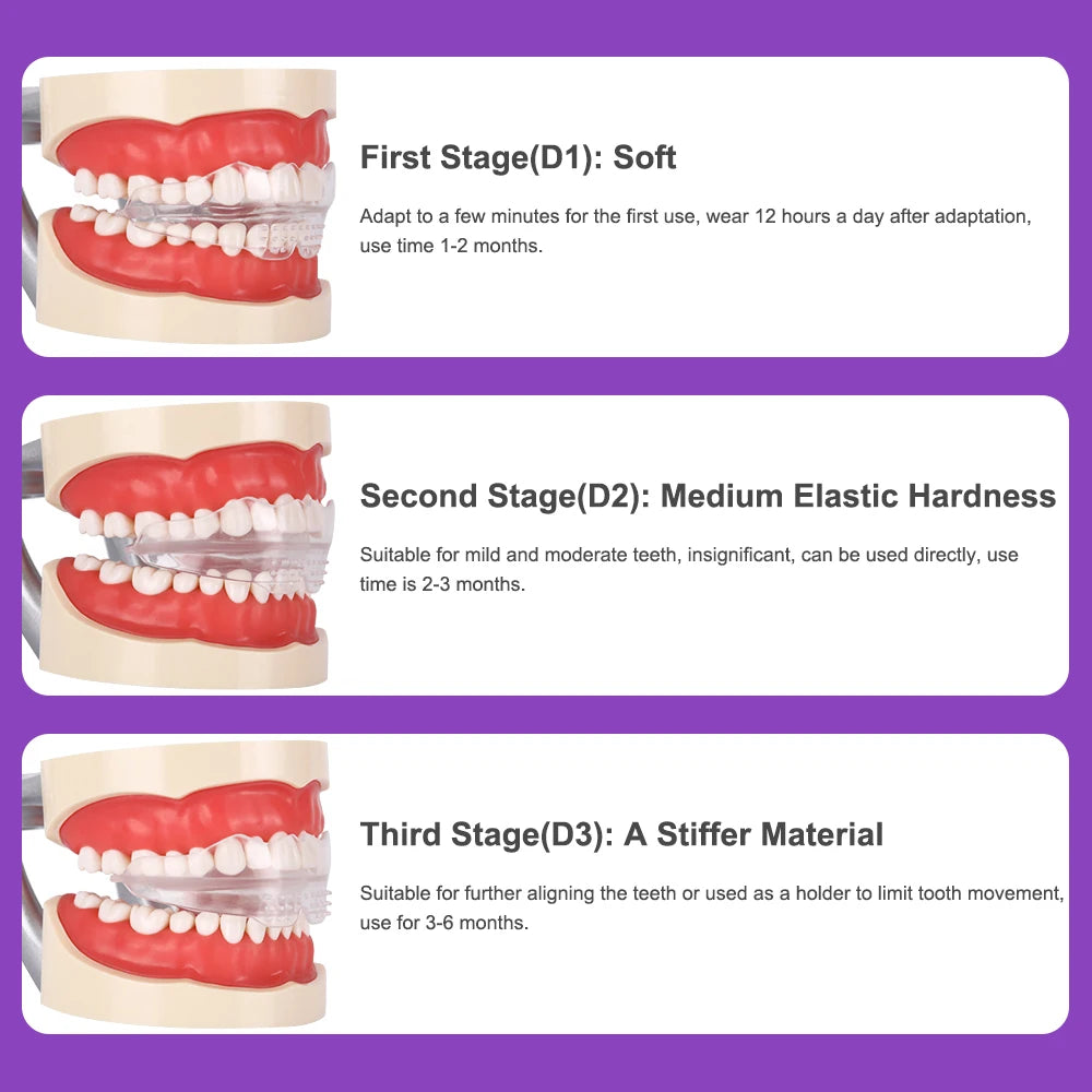 3-Stage Teeth Alignment Orthodontic Mouthpiece for Adults