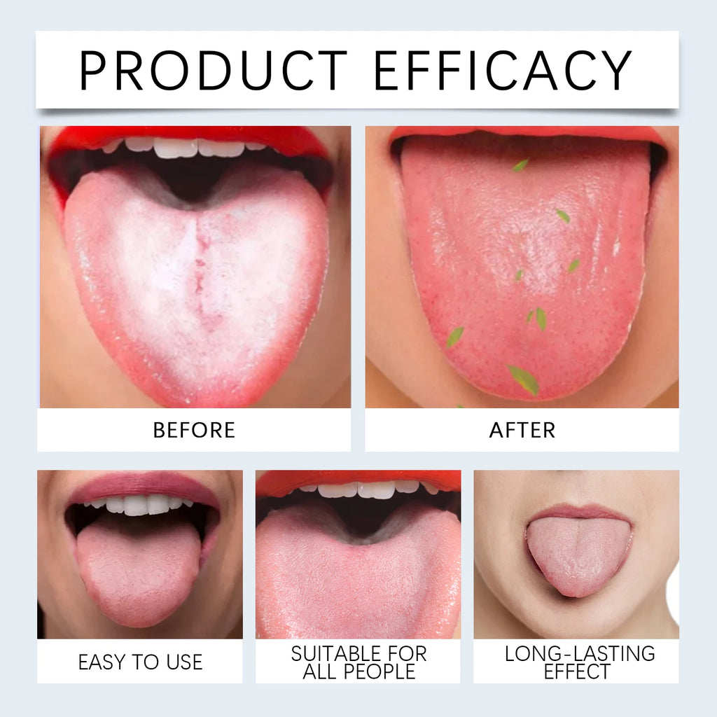 Tongue Cleaning Gel and Scraper Kit for Fresh Breath