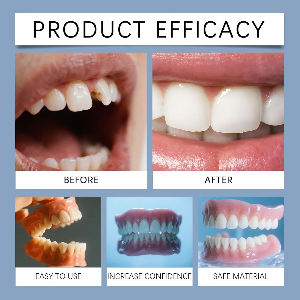Temporary Cosmetic Smile Veneers for Gaps and Missing Teeth
