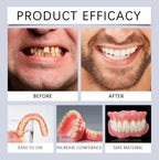 Comfort Fit Cosmetic Smile Veneers for Natural Looking Teeth